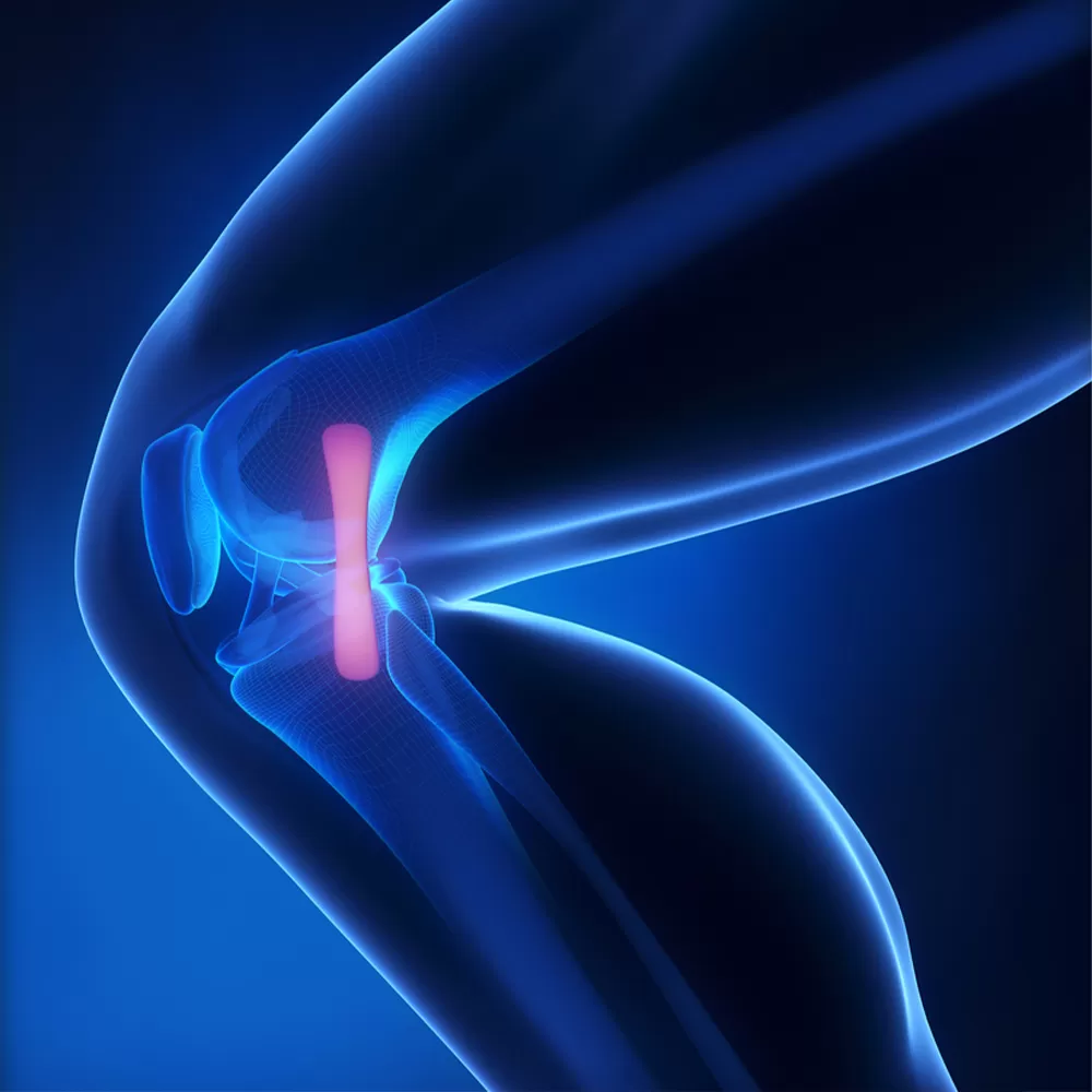Egyptian hospital surgical team preparing for knee or hip replacement procedure