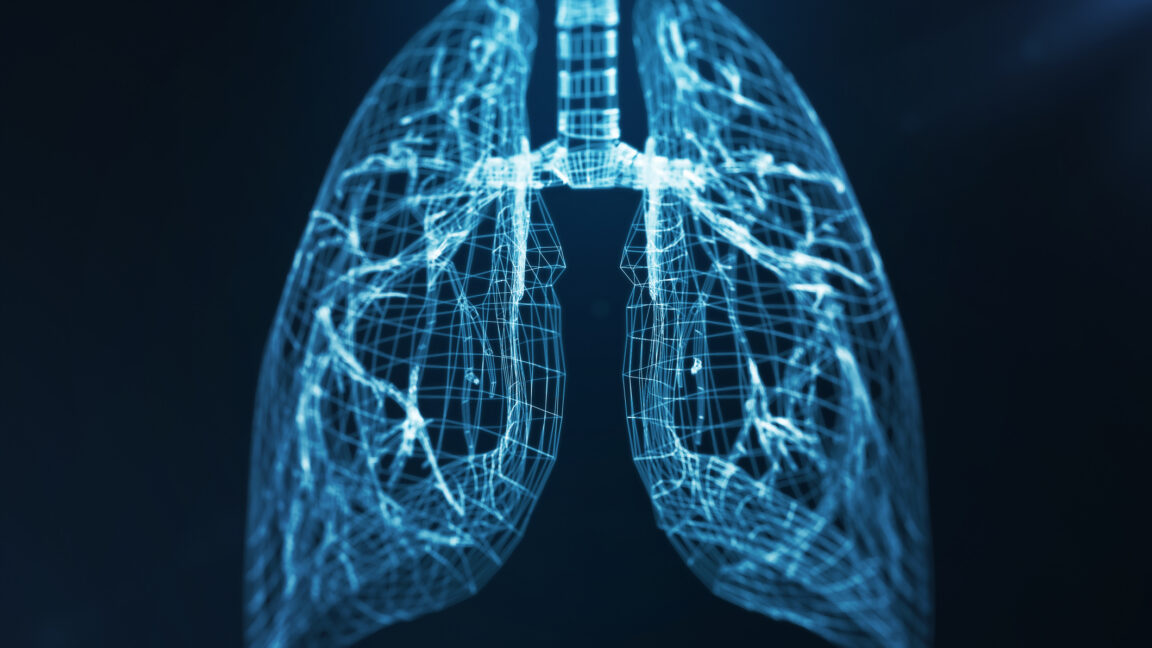 Man Lived 48 Hours Without Lungs, Got New Ones