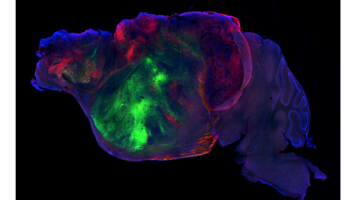 Stanford Replaces Mouse Brain with Human Cells Successfully