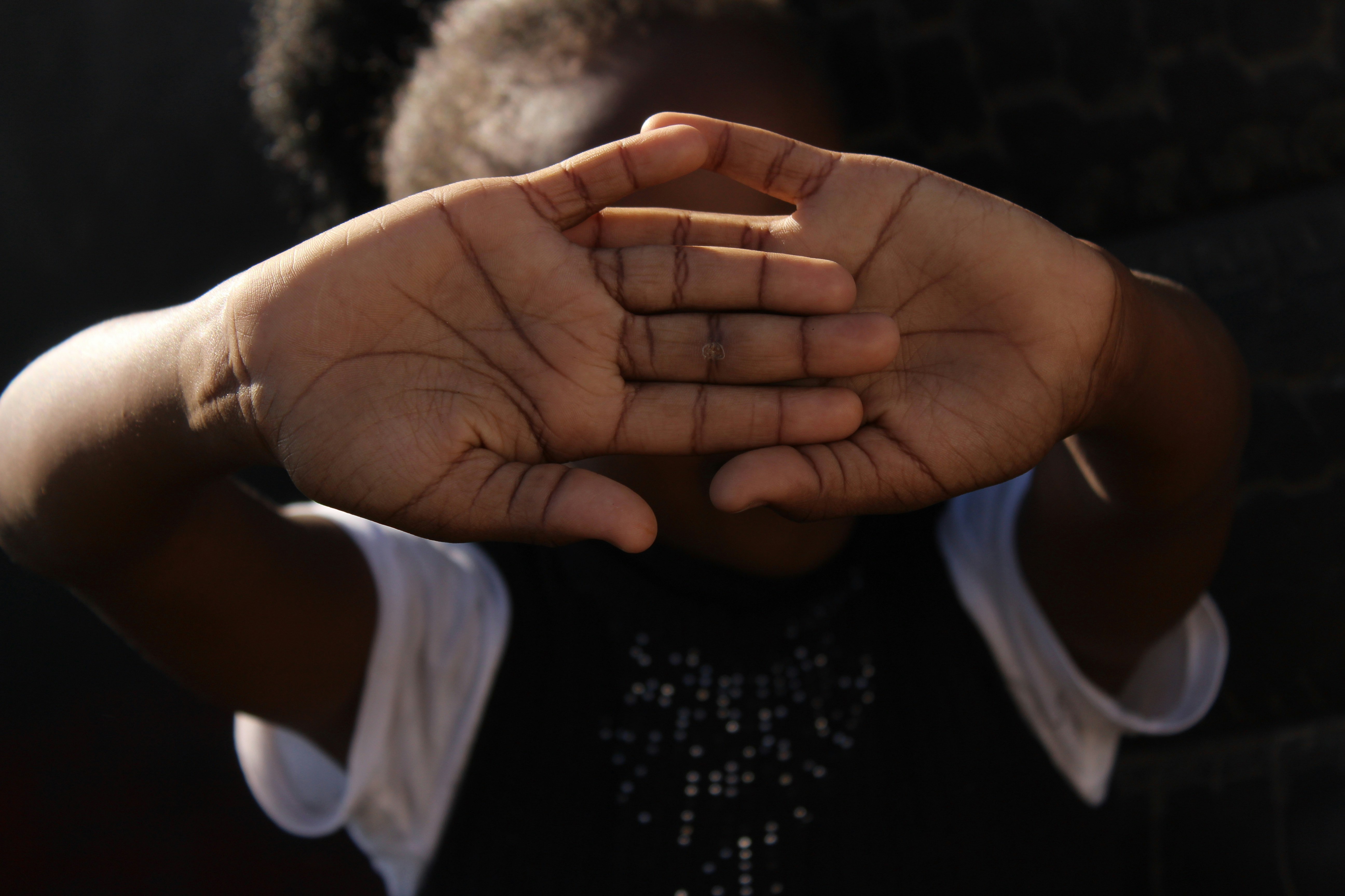 South Africa Pushes for Full Cleft Care Beyond Surgery - Image 2