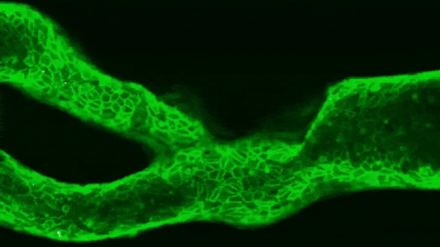 Scientists Create Tiny Arteries to Predict Stroke Risk