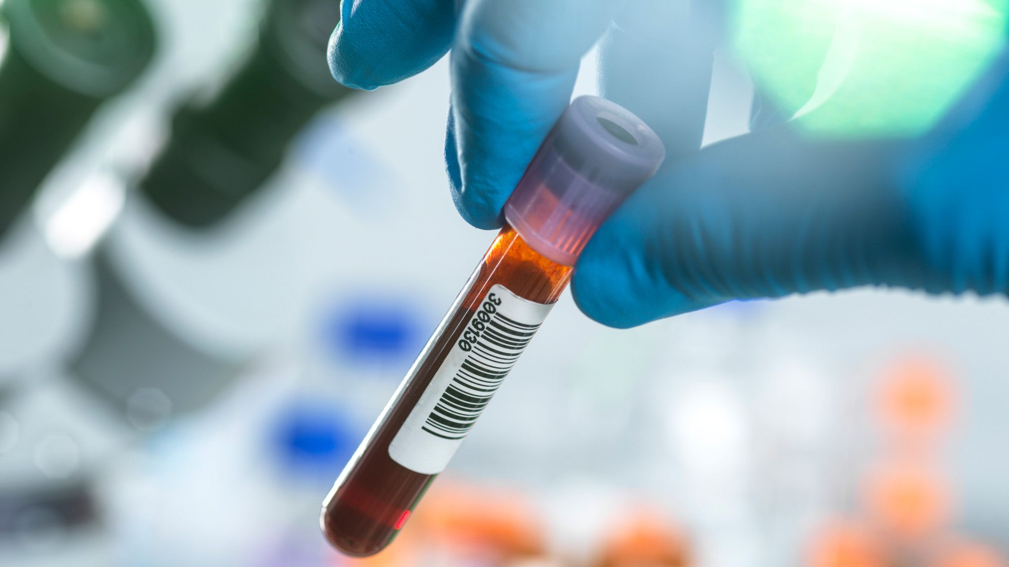Microscope view of immune cells in blood sample showing colorful white blood cells