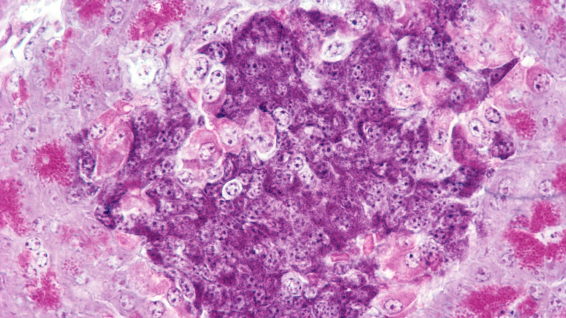 Scientists Cure Type 1 Diabetes in Mice Without Drugs