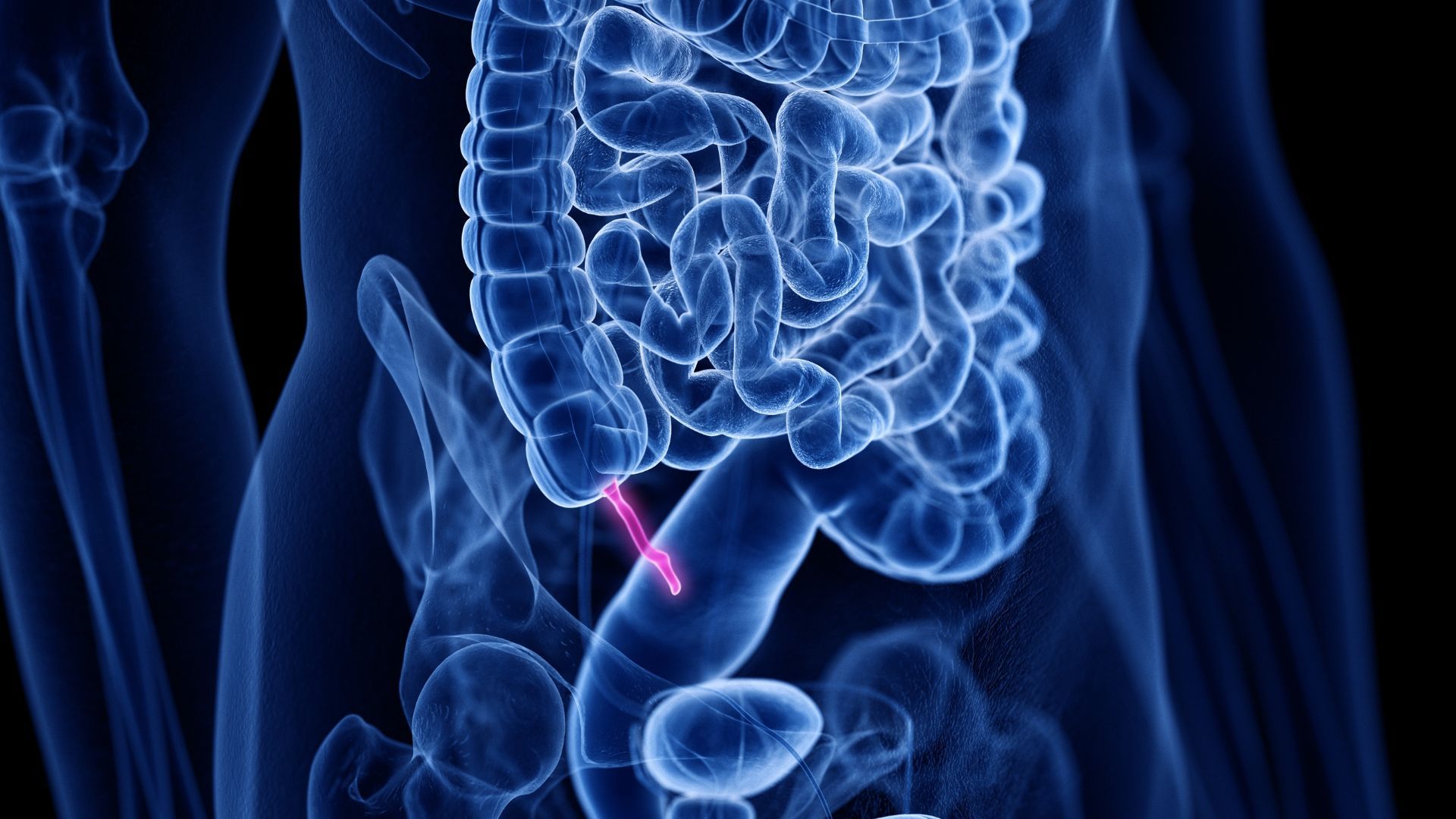 Your Appendix Evolved 32 Times—It's Not Useless After All