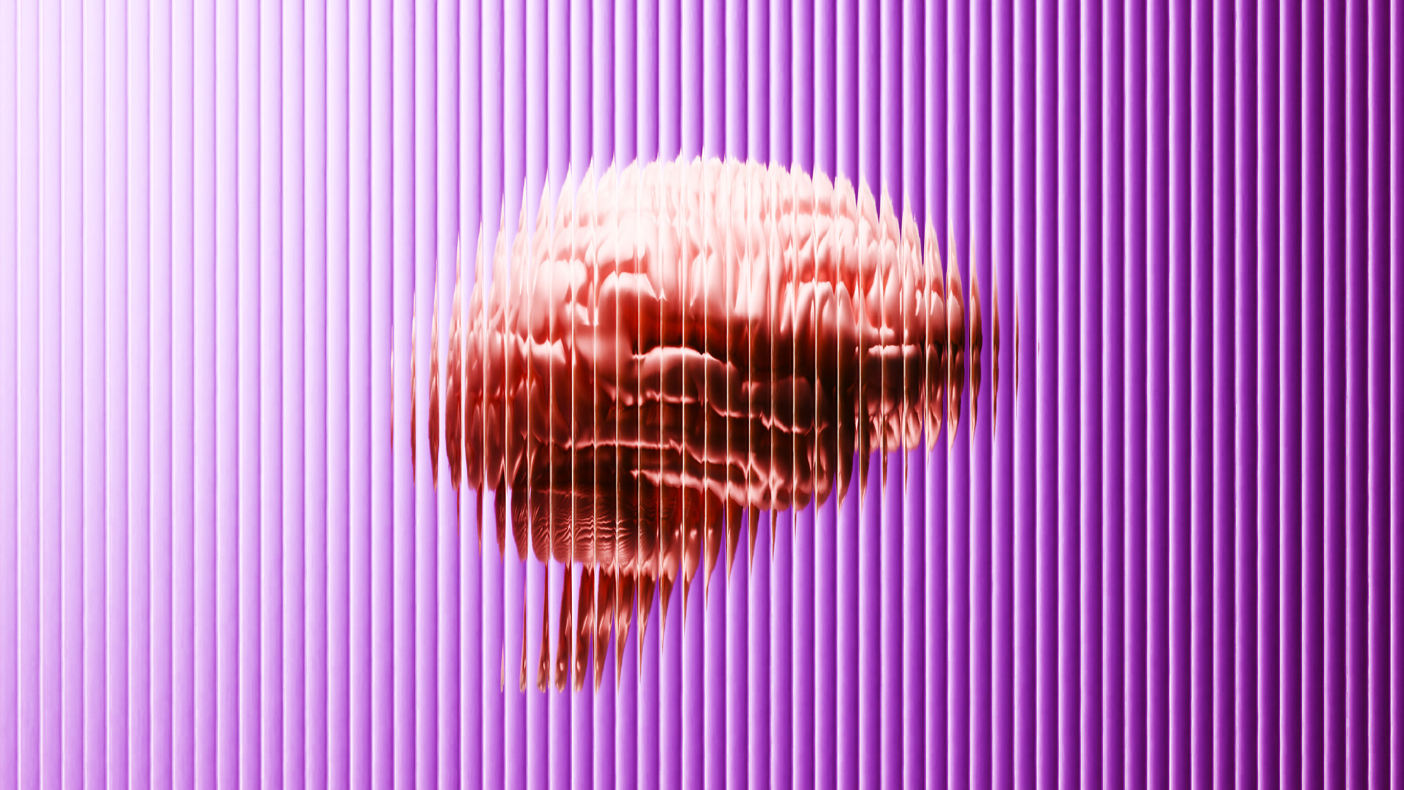 Ultrasound Treatment Eases Delusions in Schizophrenia Trial - Image 3