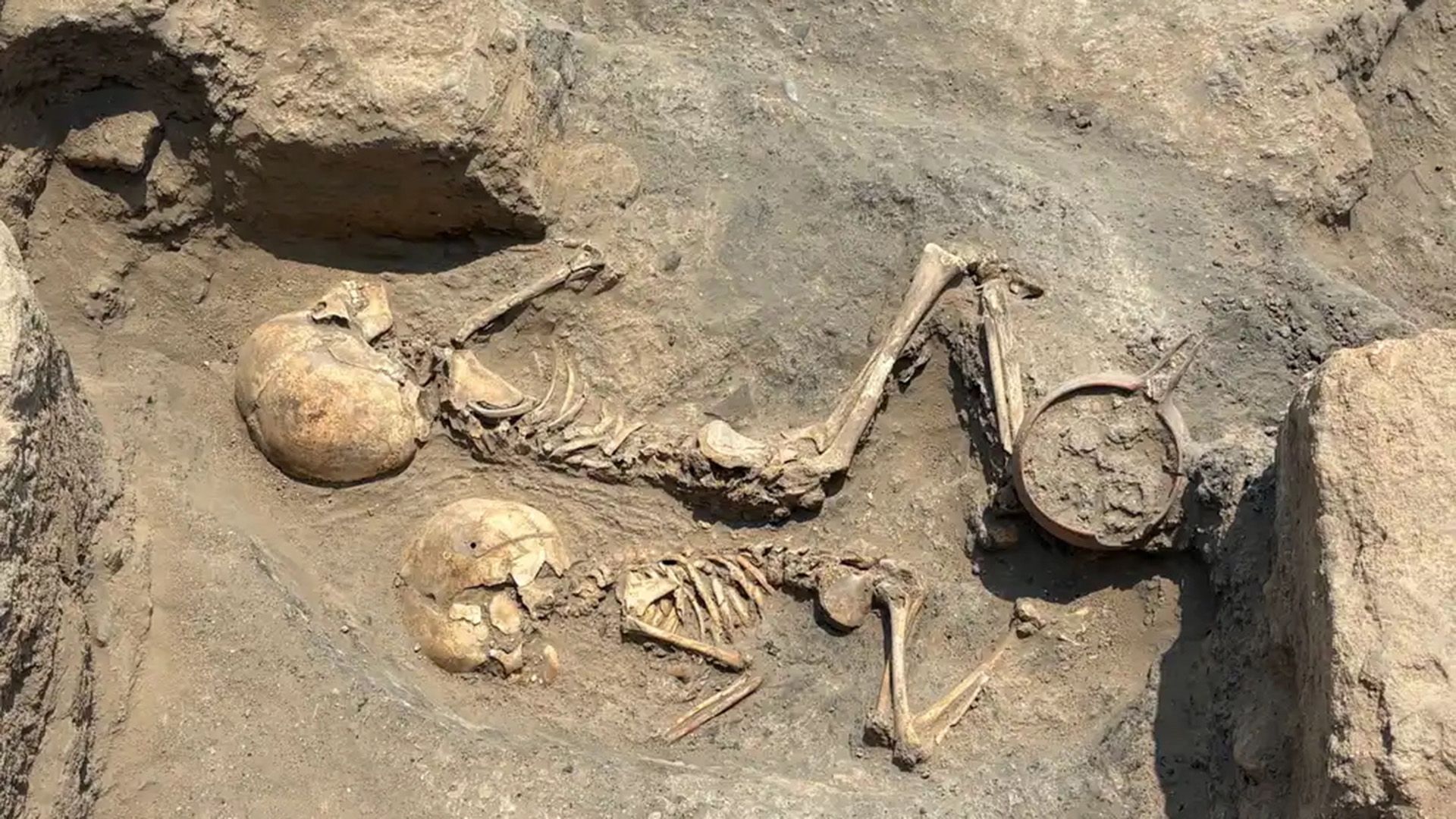 Ancient skull of Bronze Age child showing evidence of surgical trepanation from 4,000 years ago