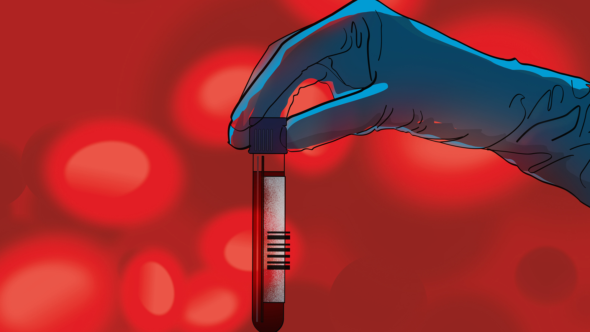 New Blood Tests Catch Alzheimer's Earlier Than Ever