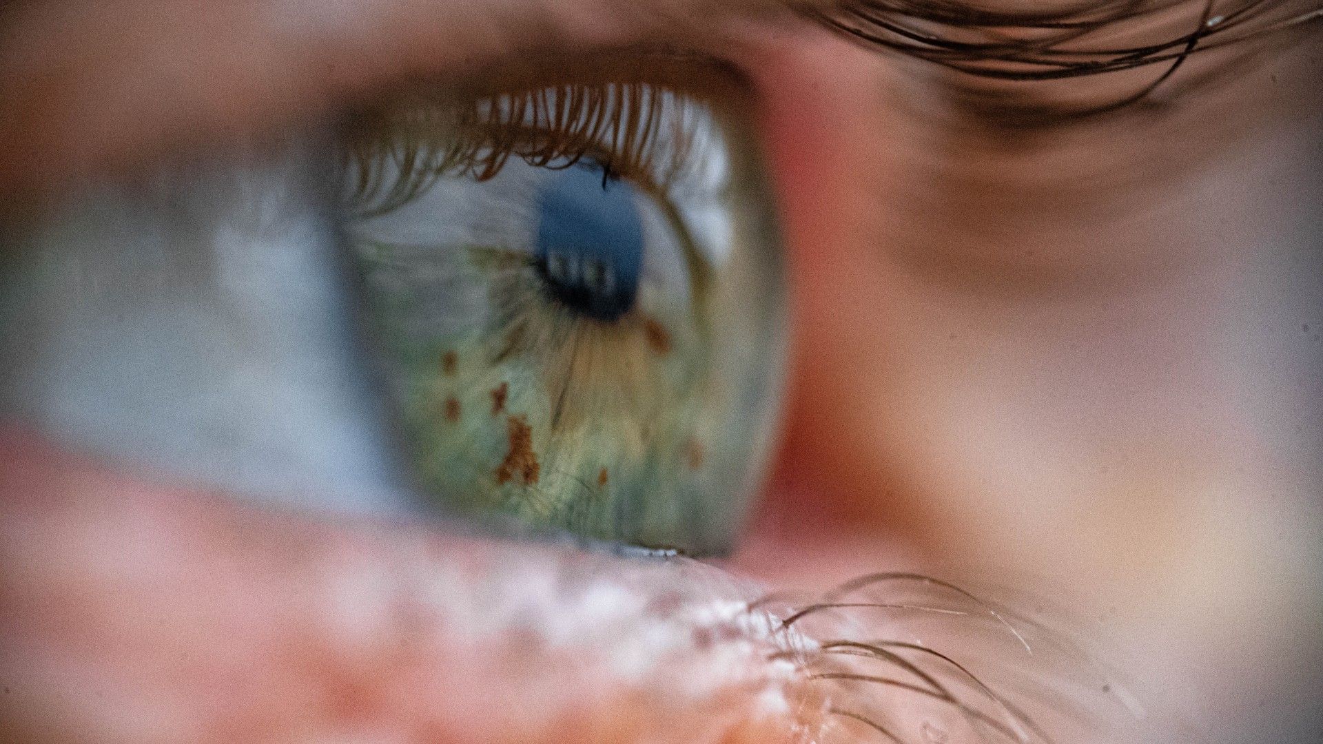 New Eye Test Detects Anemia Without Needles in 10 Seconds