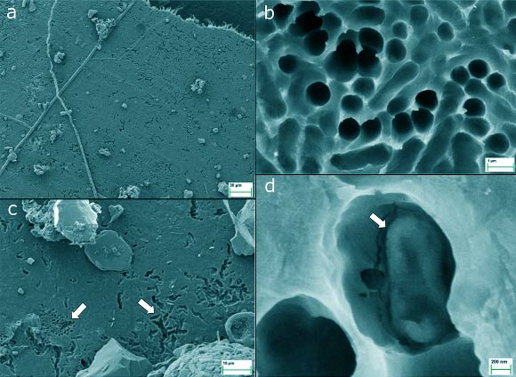 Soil Bacteria Enzyme Breaks Down Plastic and Antibiotics