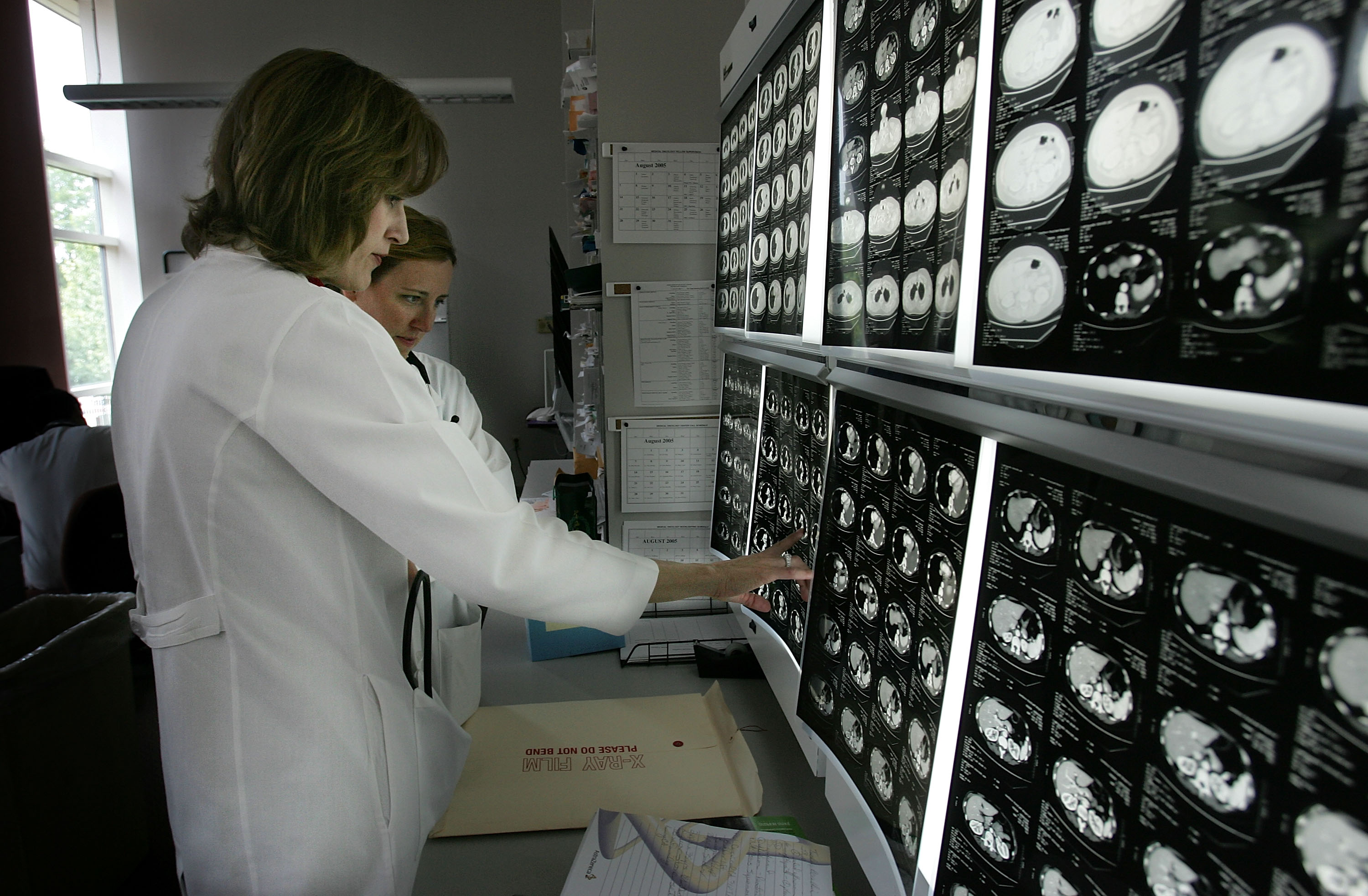 Alzheimer's Protein May Be Key to Memory, Study Finds