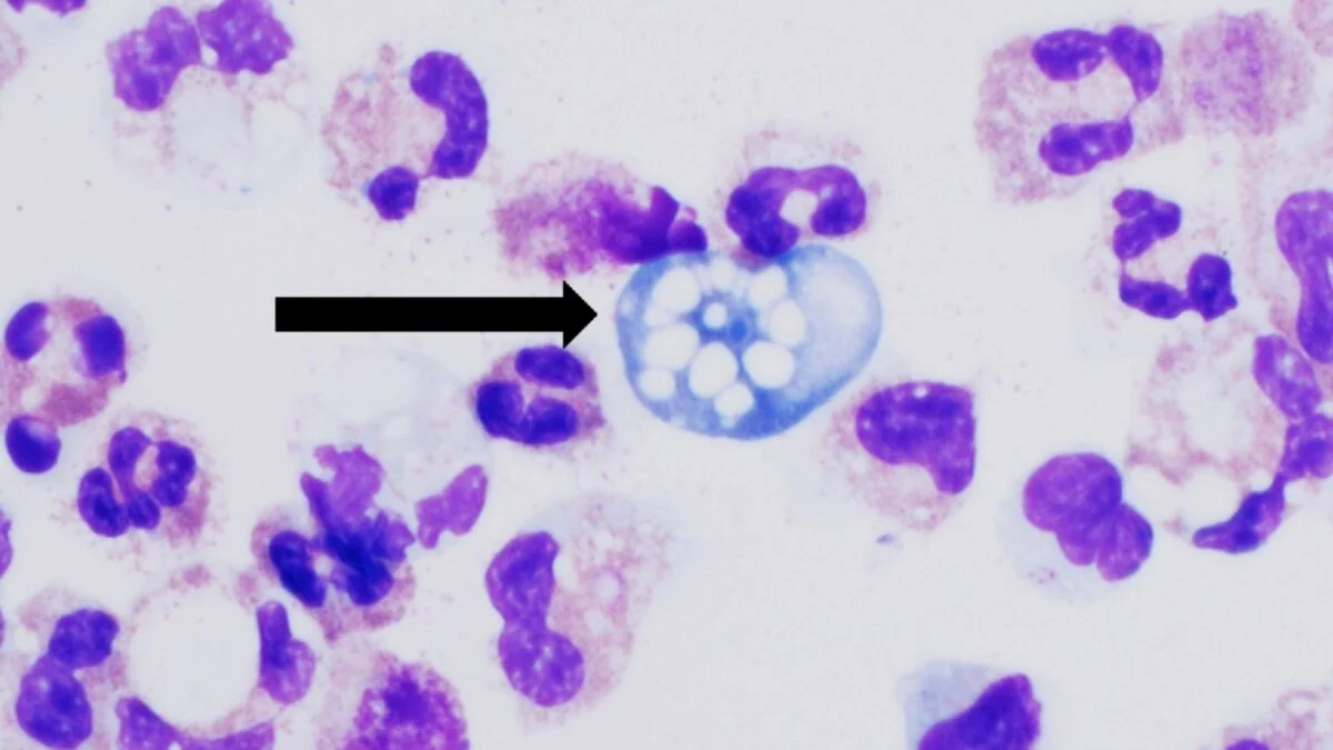 Scientists Find Ocean Compound That Kills Brain Amoeba Fast