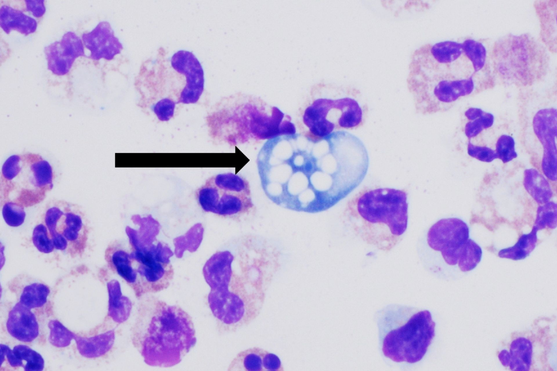 Scientists Find Ocean Compound That Kills Brain Amoeba Fast - Image 2