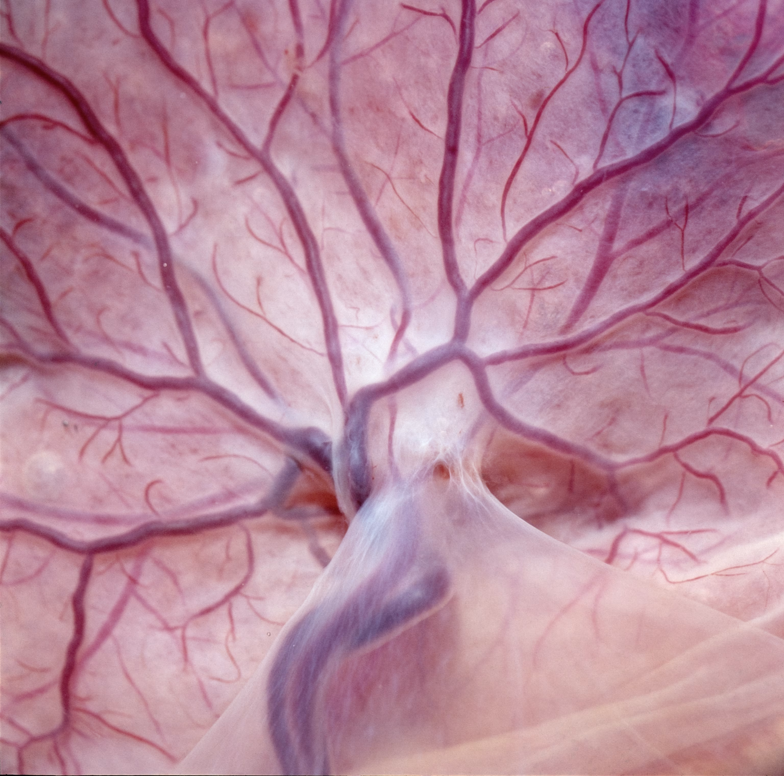 Scientists Find Gene Behind Preeclampsia Deaths - Image 4