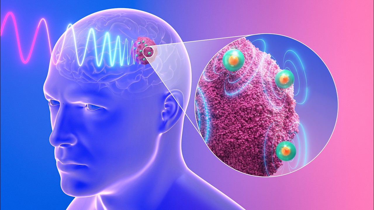 MIT's Tiny Nanoantennas Kill Brain Cancer Without Surgery - Image 2