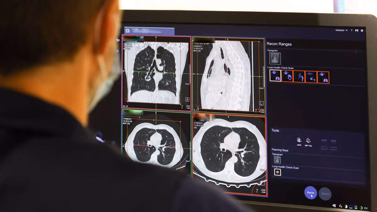 Medical professional reviewing CT scan images on computer screen showing AI cancer detection system