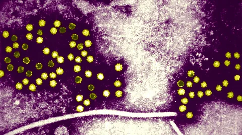 DNA Test That Finds Unknown Infections Saves Lives - Image 3