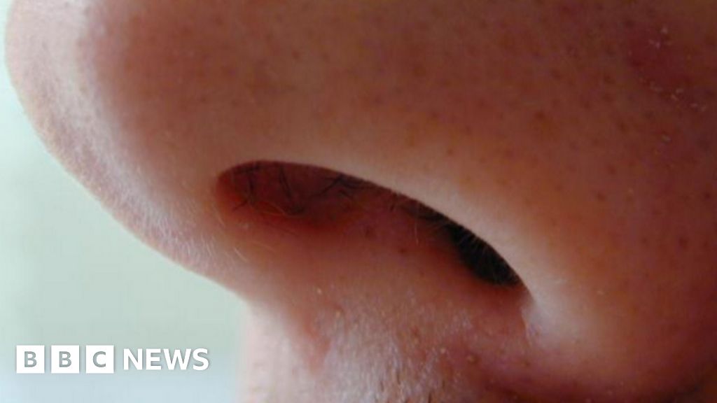New Nose Treatment Transforms Lives in Hull Hospitals