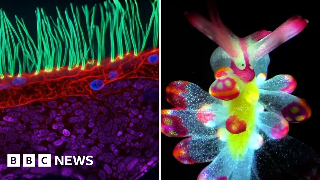 Tiny Organisms Dazzle in Microscopic Video Competition