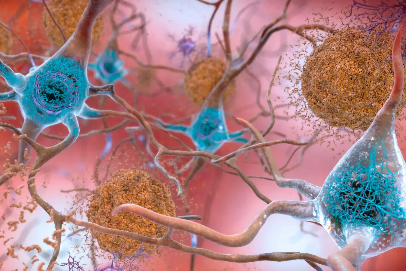 Women's Memory Strength May Delay Alzheimer's Diagnosis - Image 4