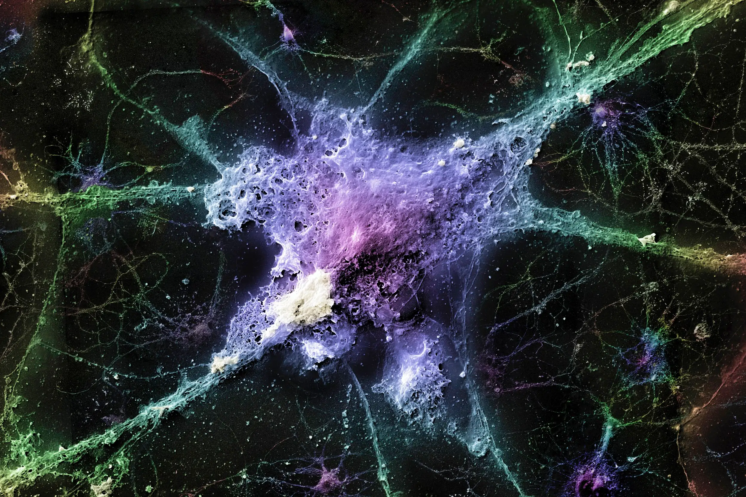 New Brain Treatment Boosts Memory in Alzheimer's Mice
