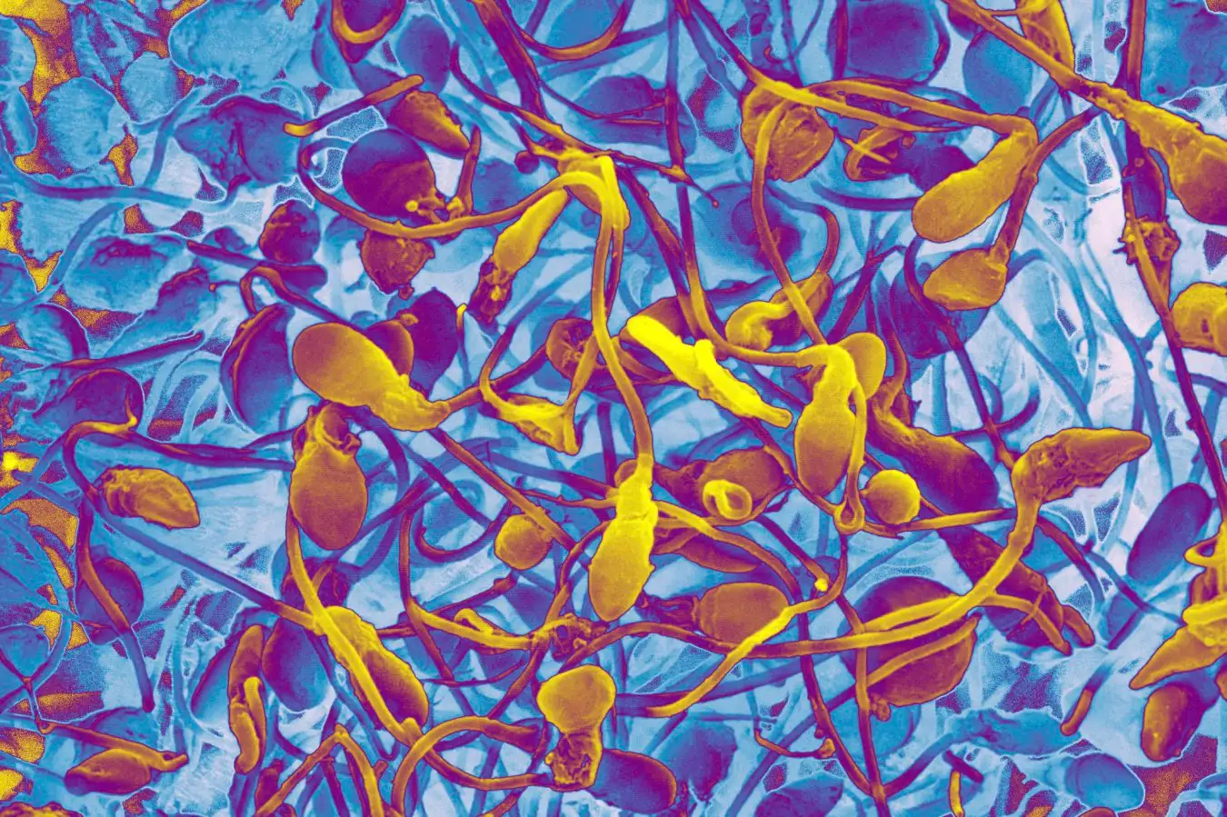 Lab-Grown Sperm Could Help Infertile Men Become Fathers