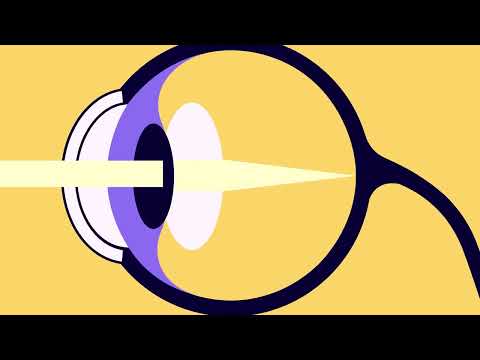 Gene Therapy Repairs Damaged Vision in Dogs, Maybe Humans - Image 3
