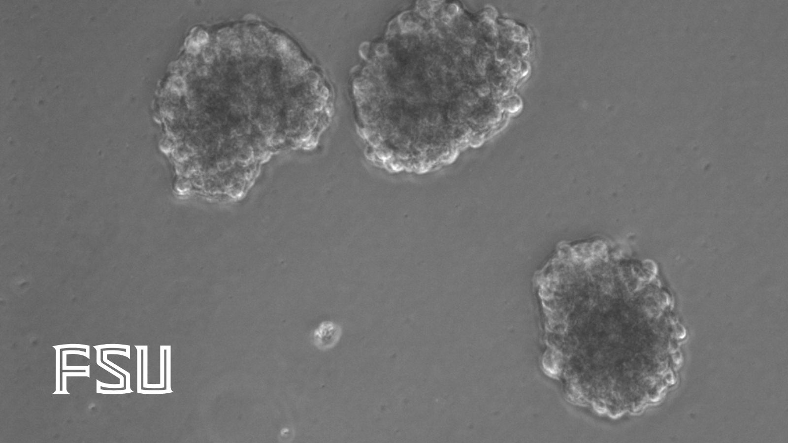 Microscopic view of stem cells releasing extracellular vesicles for stroke treatment research