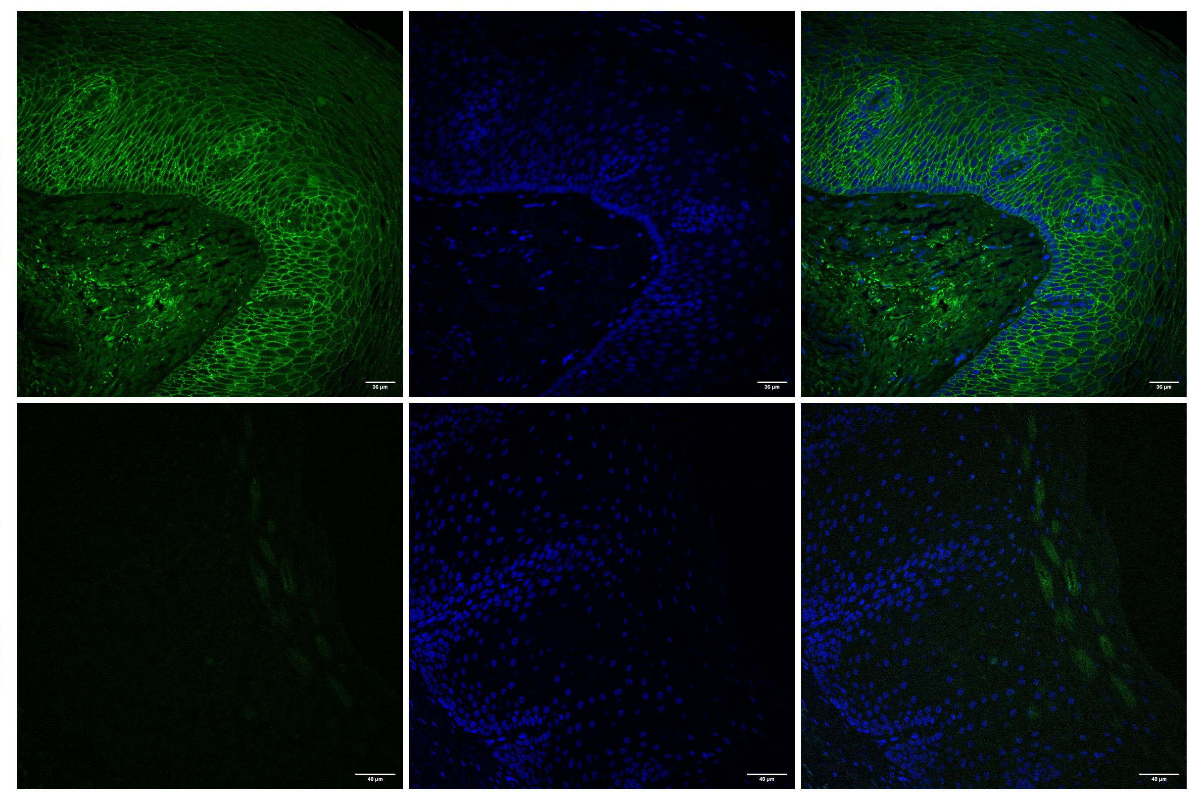 MIT Creates Gel That Delivers Drugs to the Esophagus