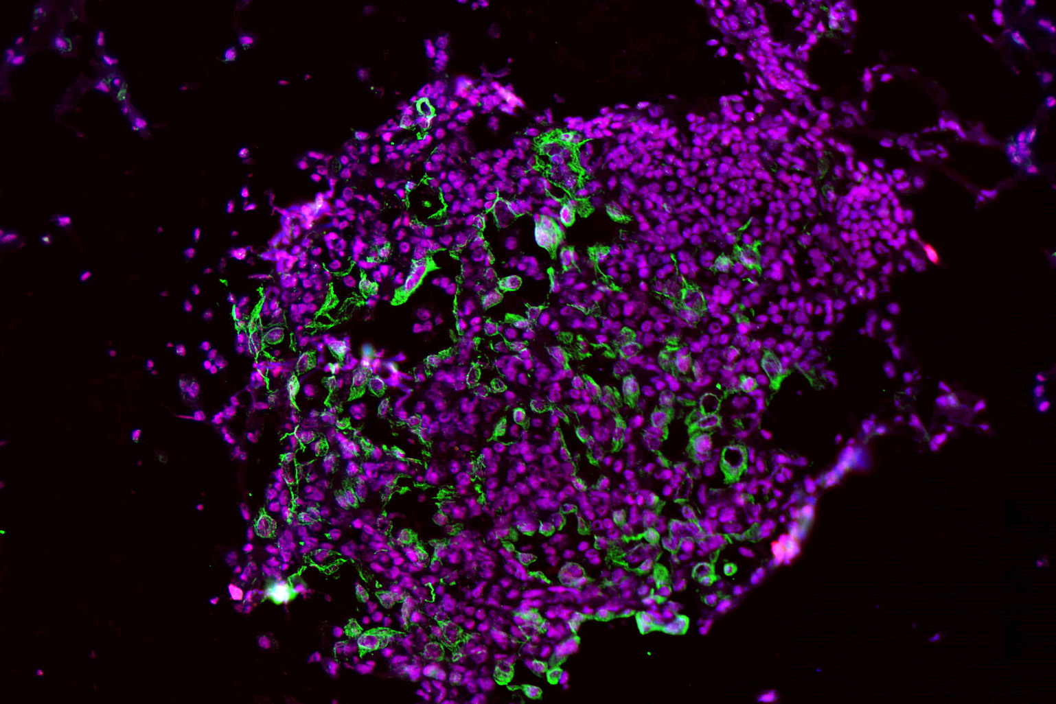 MIT Drug Cuts Lung Cancer Risk in Early Trials