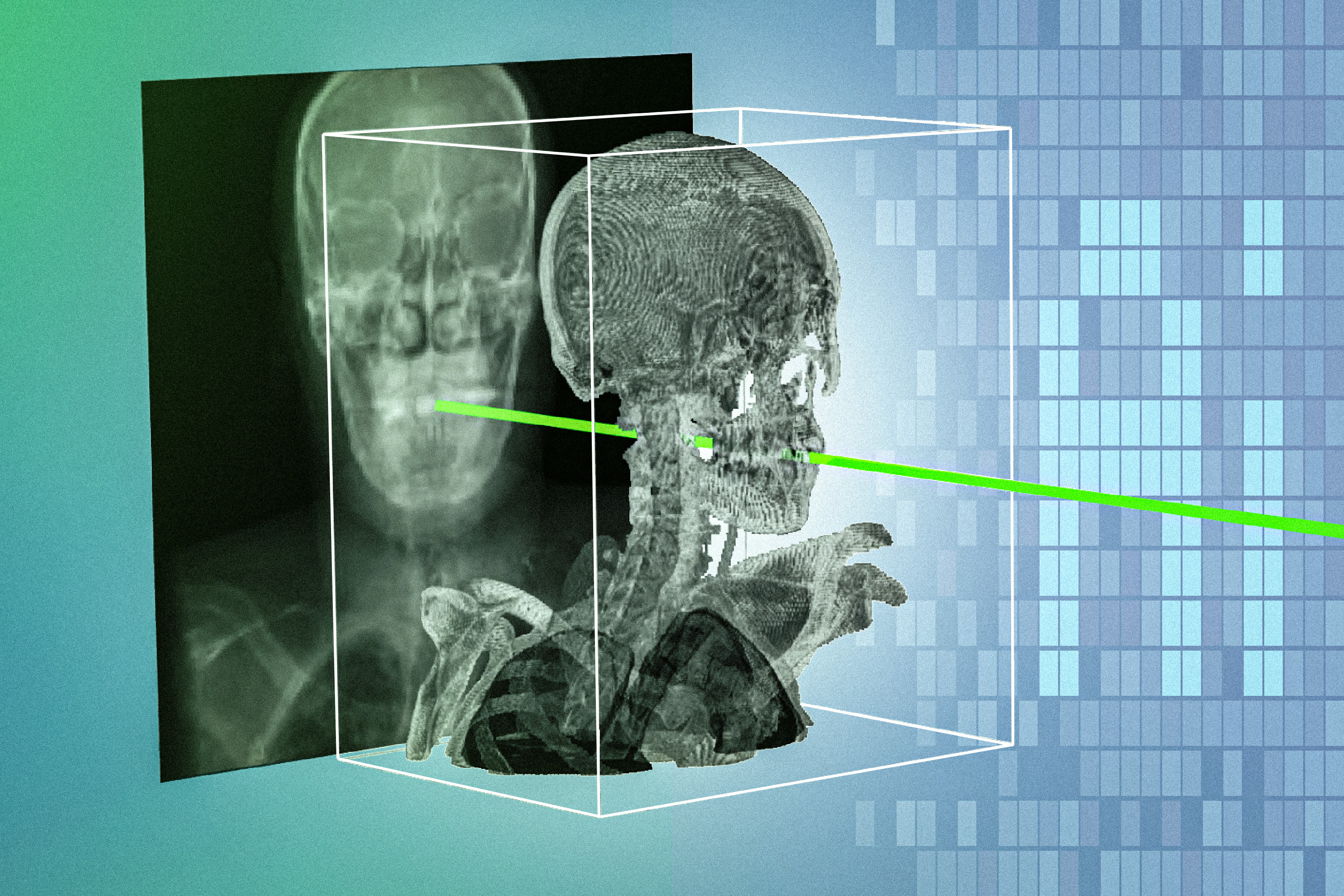 MIT's AI Makes Surgeries Safer in Seconds