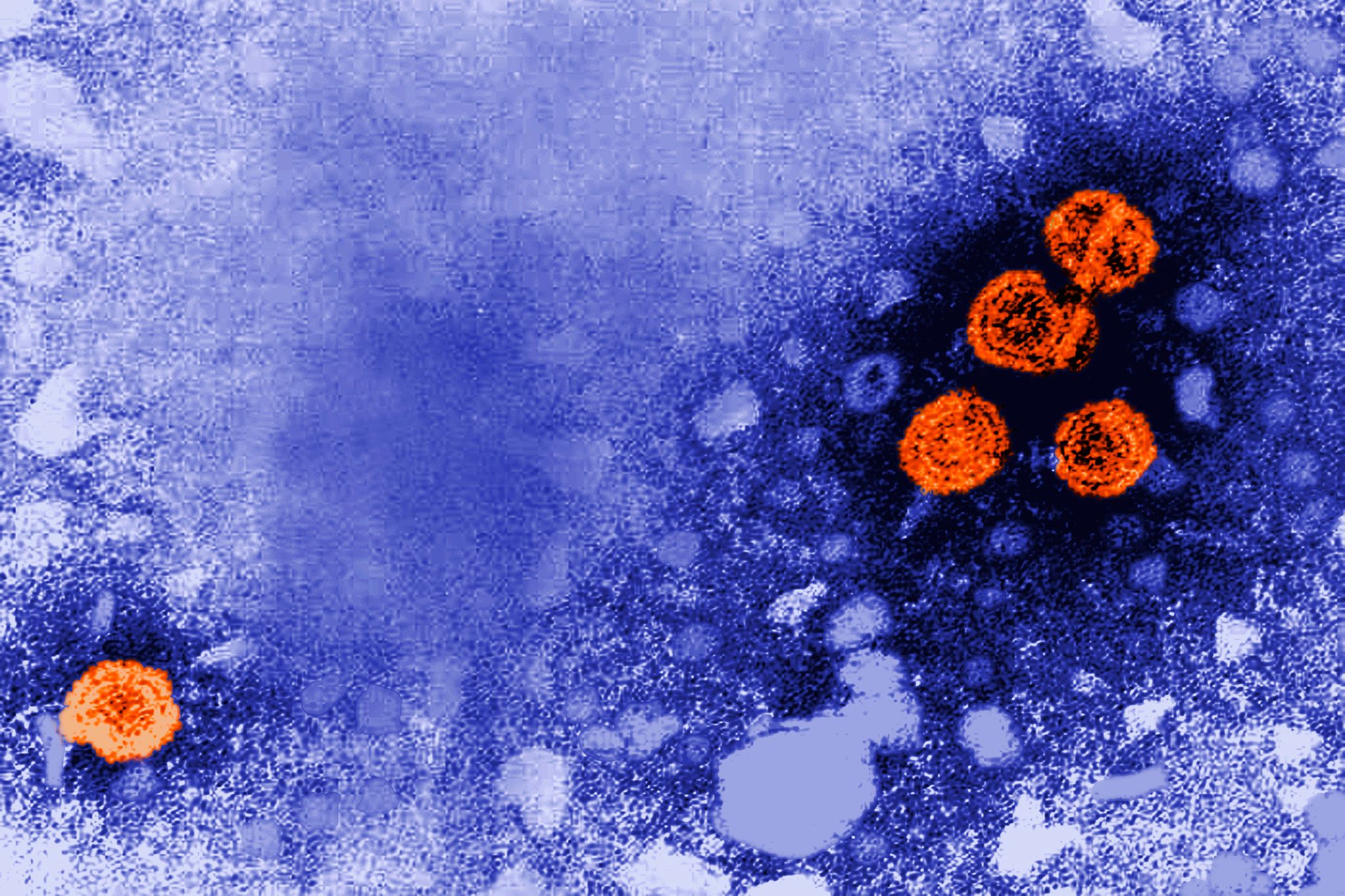 New Hepatitis B Drug Offers Functional Cure for 20%
