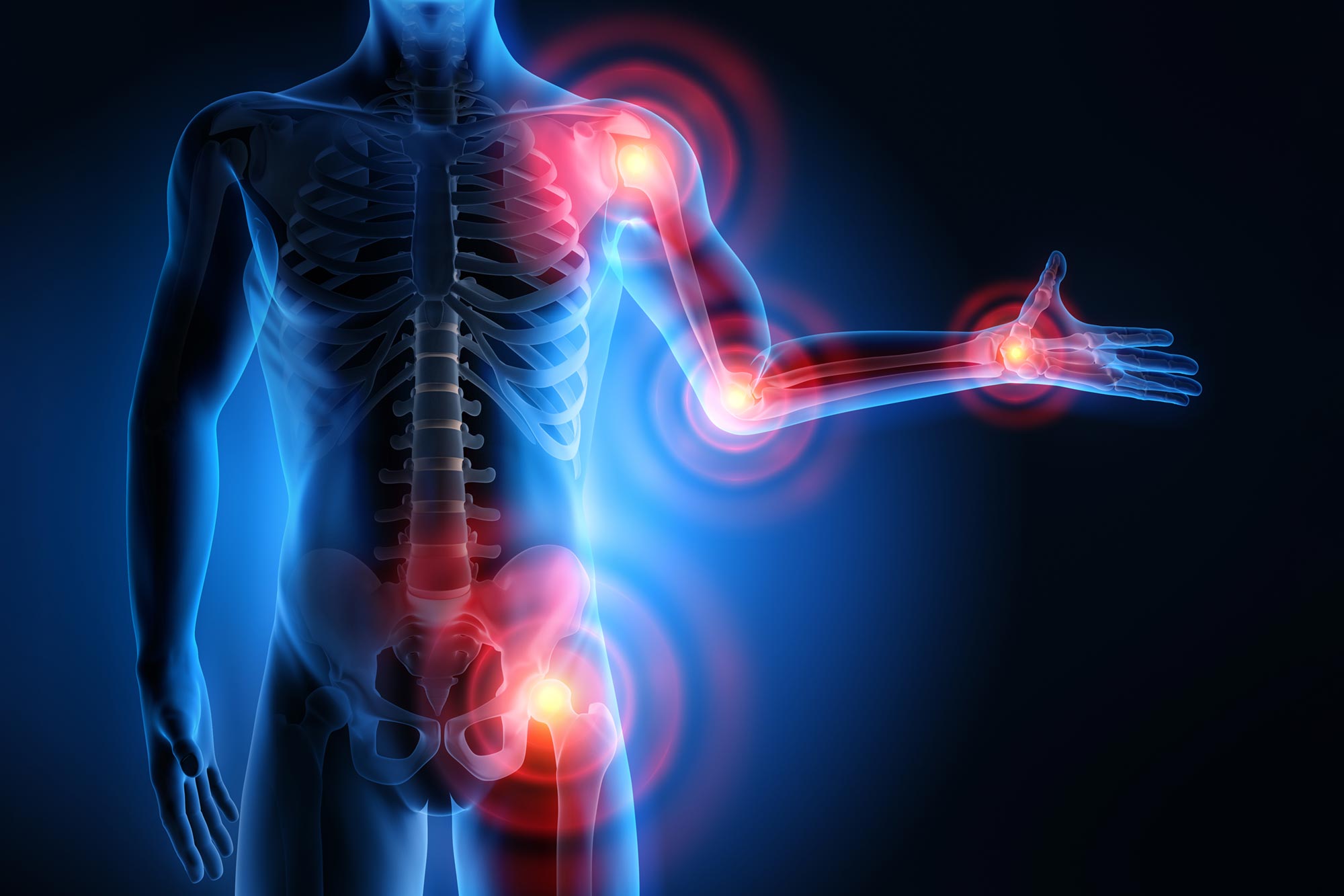 Scientists Find Body's Natural "Off Switch" for Pain