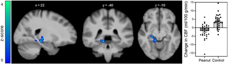 Daily Peanuts Boost Memory in Adults Over 60, Study Finds - Image 2