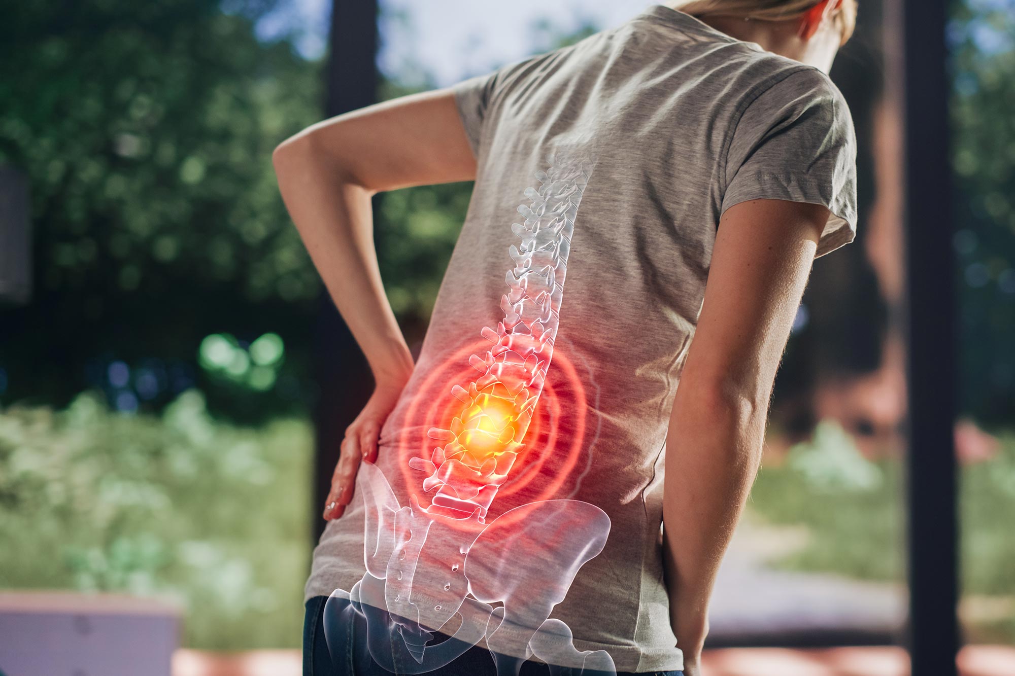 Osteoporosis Drug May Stop Chronic Back Pain at the Source