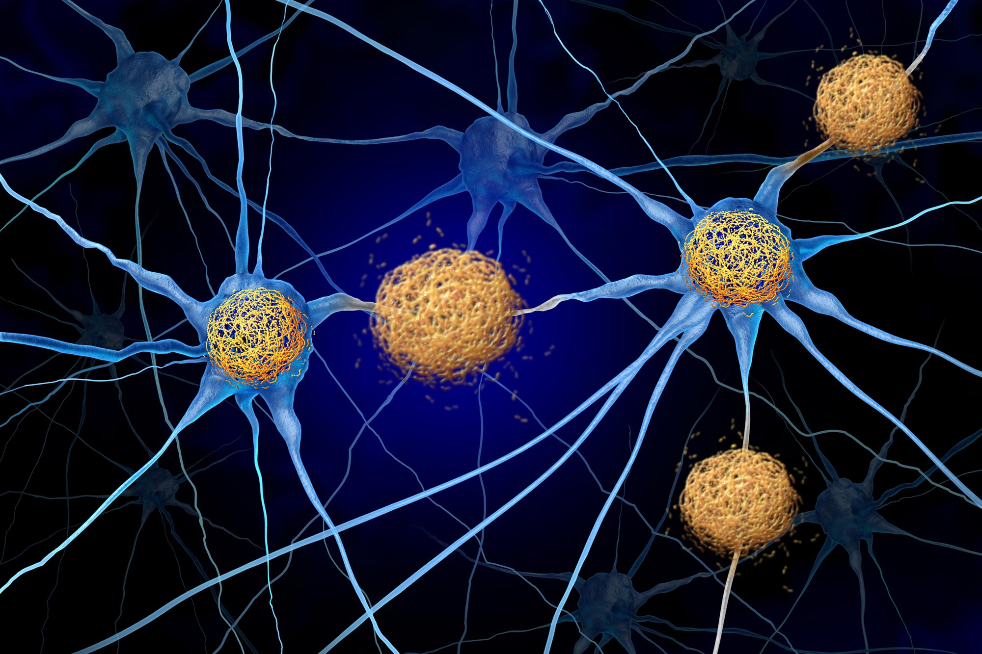 Alzheimer's Protein Tau Actually Helps Build Lasting Memories