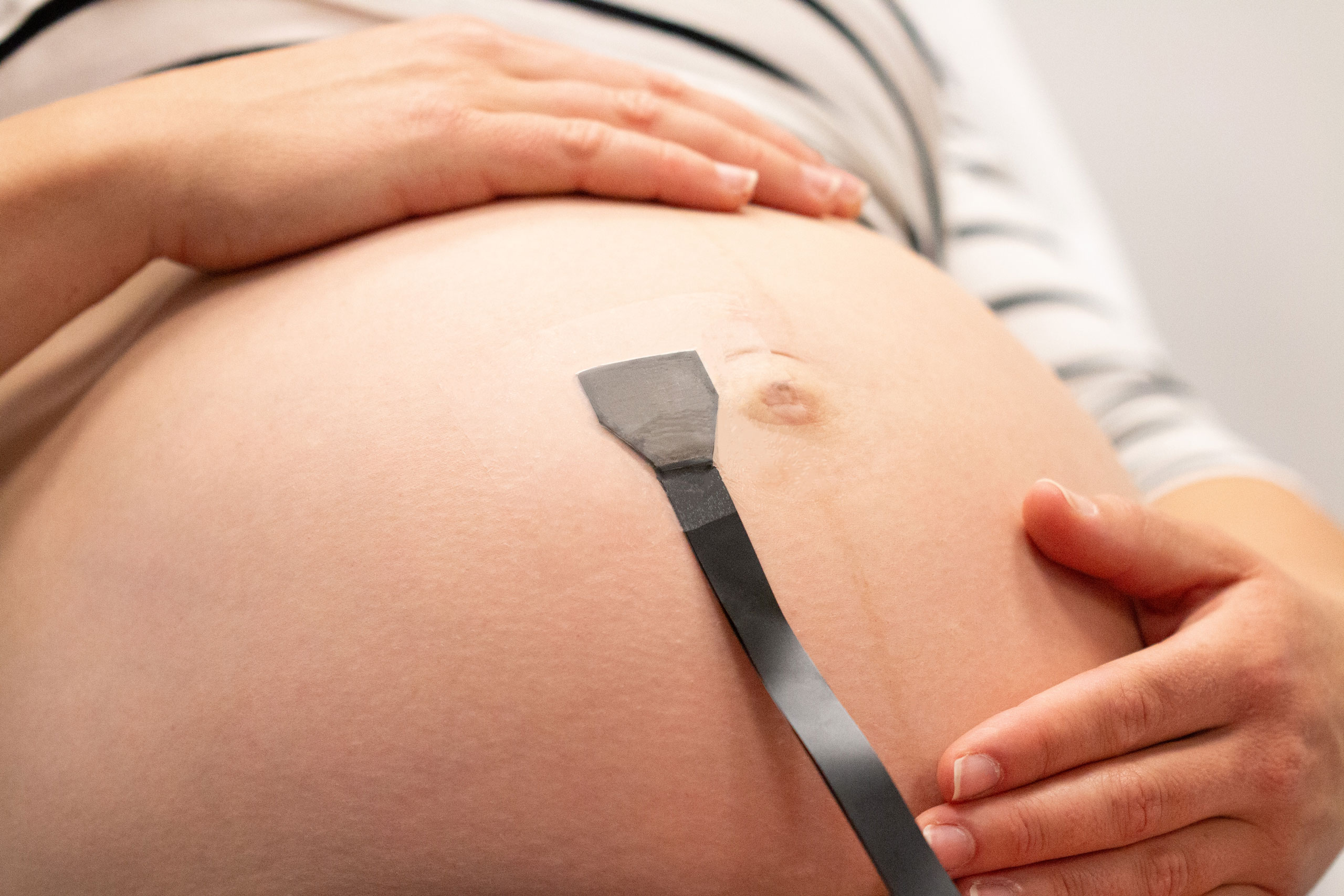 UC San Diego's Pregnancy Patch Saves Baby at 29 Weeks