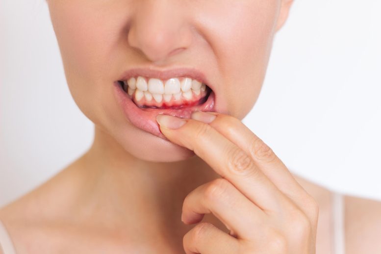 New Light Therapy Treats Gum Disease, Keeps Good Bacteria