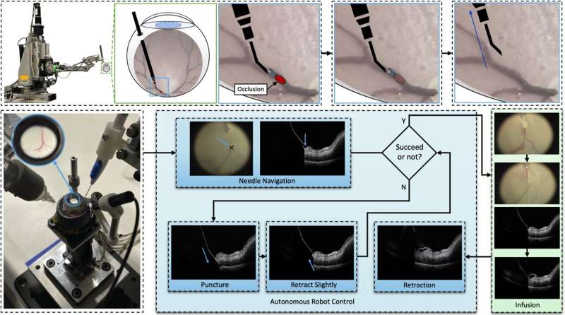 Robot Successfully Performs Delicate Eye Surgery on Pig Eyes - Image 4