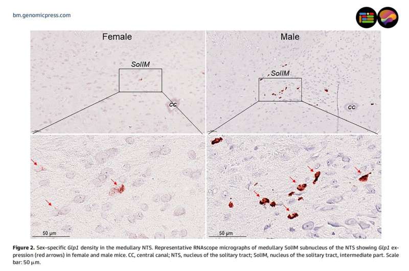 Scientists Map Brain Differences in Weight-Loss Drug Effects - Image 3