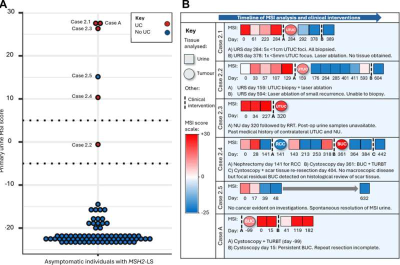Simple Urine Test Detects Cancer Before Symptoms Appear - Image 3