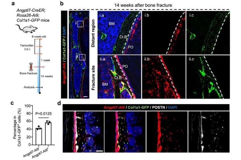Scientists Find Special Cells That Heal Broken Bones - Image 3