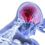Scientists Crack Code of Chronic Pain Neurons - Image 4