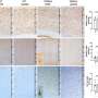 Iron Supplements Restore Muscle Strength in Dystrophy Study - Image 4