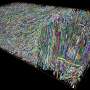 AI Model Helps Scientists Predict ALS Progression Patterns - Image 5