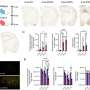 Scientists Close to Predicting Schizophrenia Before Symptoms - Image 5