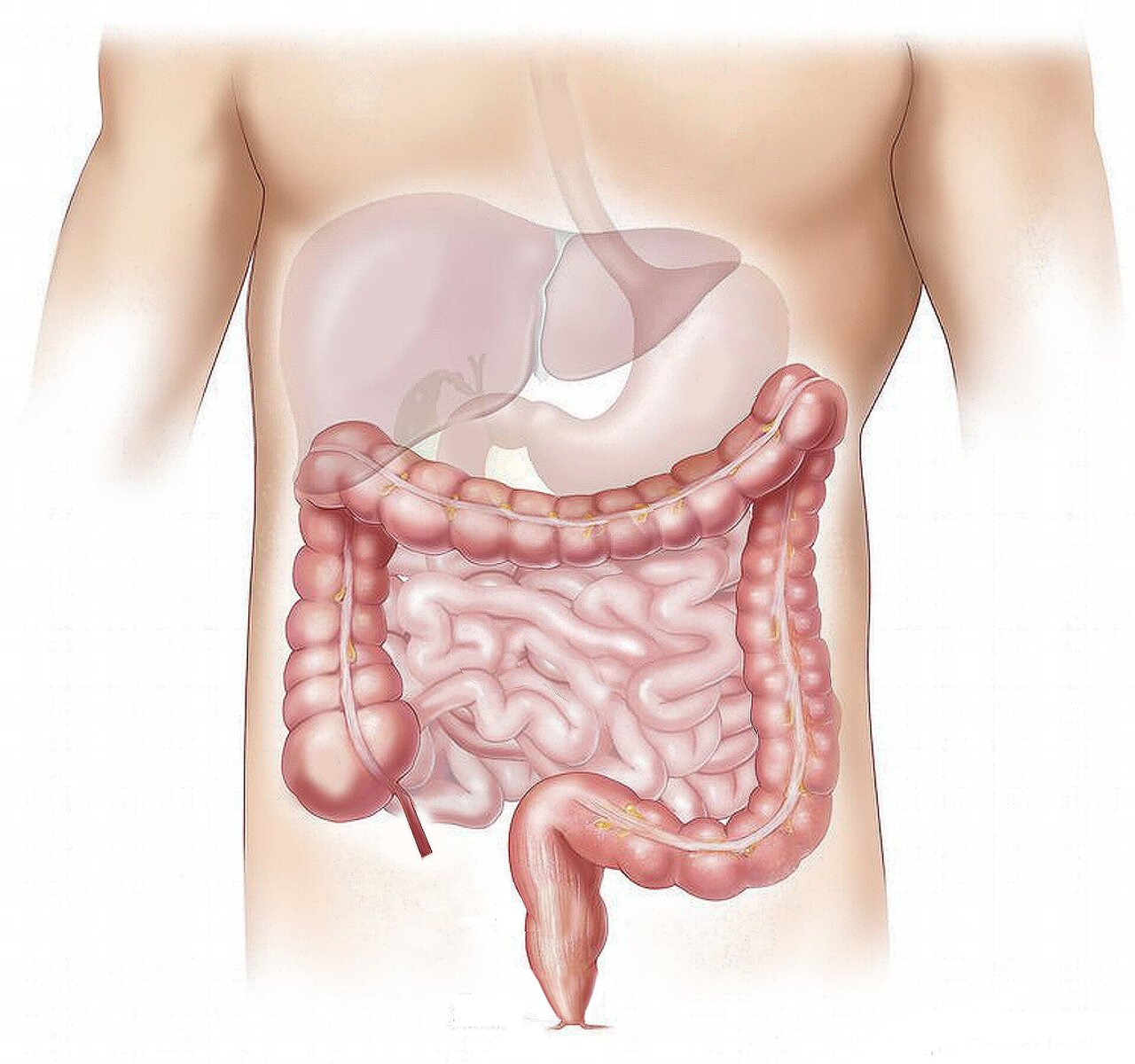 UK Study Reveals How to Catch IBD Cancer Earlier - Image 2