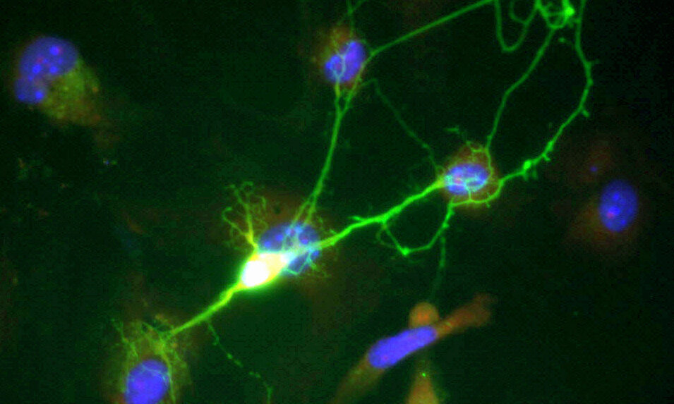 Scientists Crack Code of Chronic Pain Neurons - Image 2