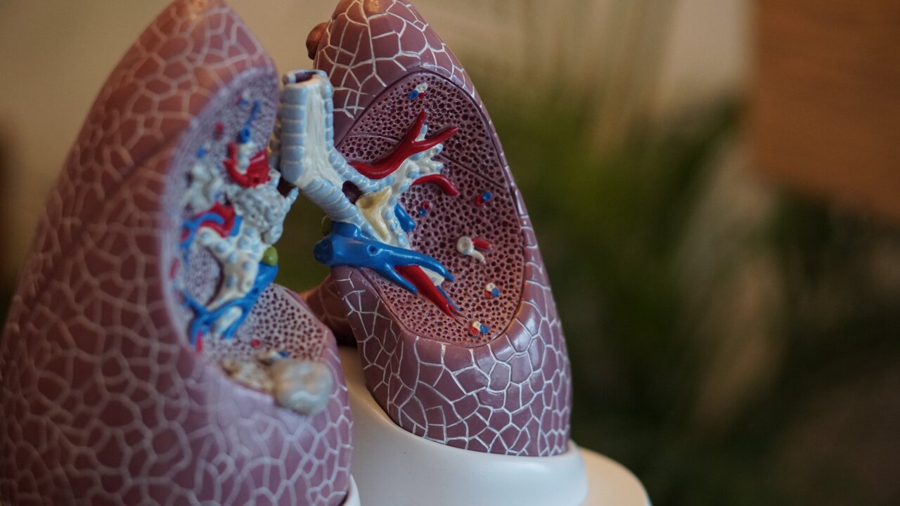 New CF Triple Therapy Cuts Inflammation 60% Long-Term - Image 2