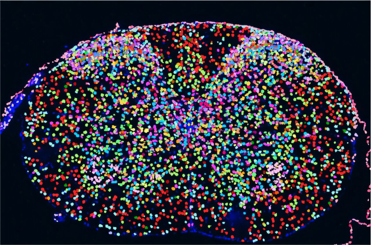 New Spinal Cord Map Could Unlock Pain Relief for Millions
