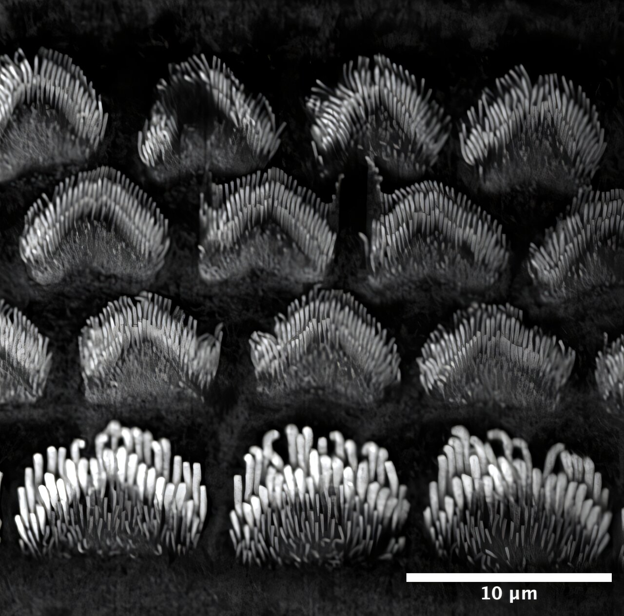 Scientists Find New Way to Prevent Permanent Hearing Loss